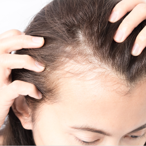 hair fall, hair loss treatment