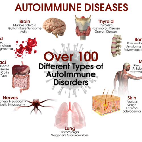 Autoimmune Diseases treatment